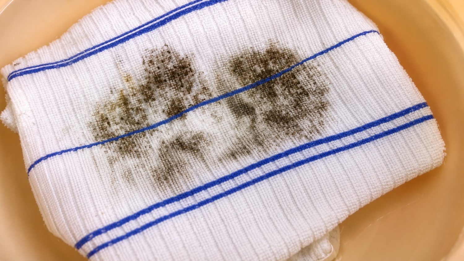 Como tirar mofo de roupas guardadas há muito tempo sem manchar o tecido e sem usar produtos químicos, segundo lavanderias