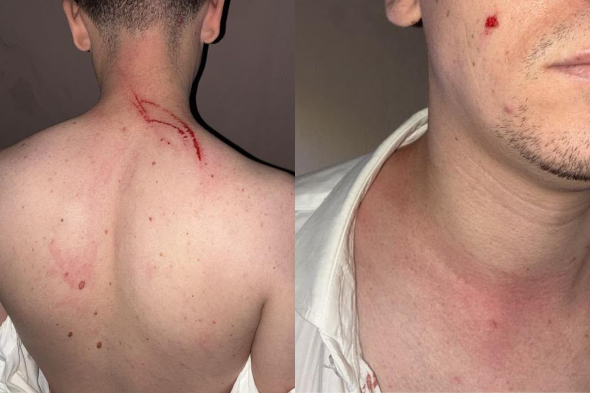 Câmara de Goianápolis se manifesta após jornalista denunciar agressão depois de sessão legislativa