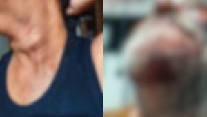 Homem foi preso após agredir companheira em Anápolis.