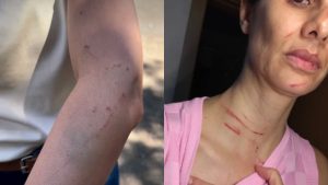 Enfermeira foi agredida após dizer a paciente que não havia vagas disponíveis para atendê-la em hospital.