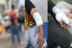 Um dos envolvidos sofreu ferimentos nas costas e no braço, outro teve um corte no braço e o terceiro ficou com uma lesão no polegar. (Foto: Reprodução)