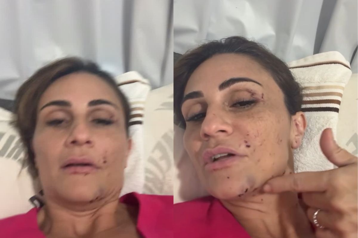 “Livramento muito grande”: psicoterapeuta sobrevive a acidente com caminhão na GO-222, em Anápolis
