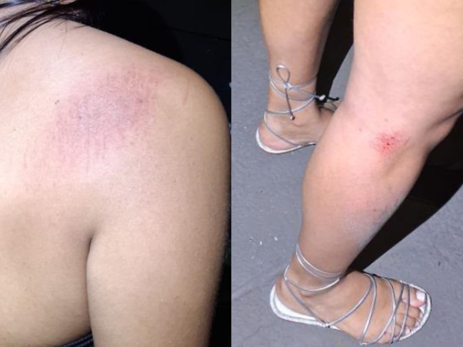 Jovem diz ter sido agredida e atropelada após discussão por conta de bar em Anápolis