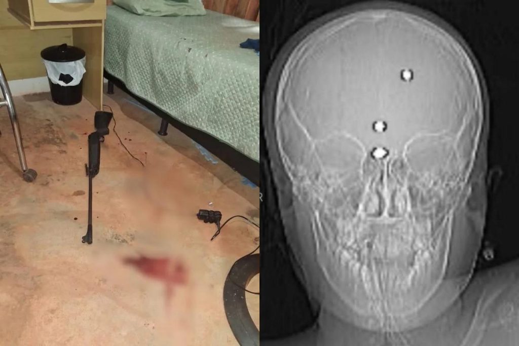 criança atingida por arma de chumbinho