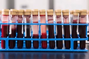 Exame de sangue que busca detectar mais de 50 tipos de câncer chega ao Brasil