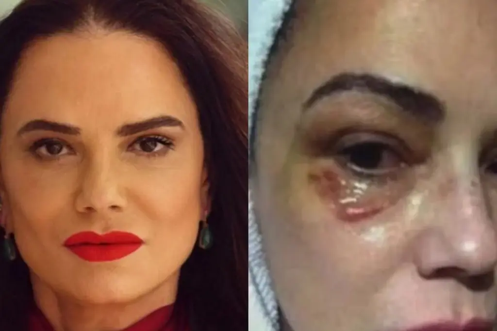 Luiza Brunet comenta indenização de R$ 150 mil por agressão de ex