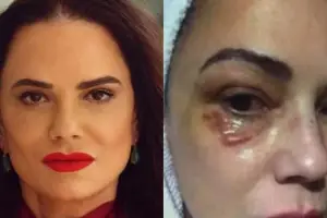 Luiza Brunet comenta indenização de R$ 150 mil por agressão de ex