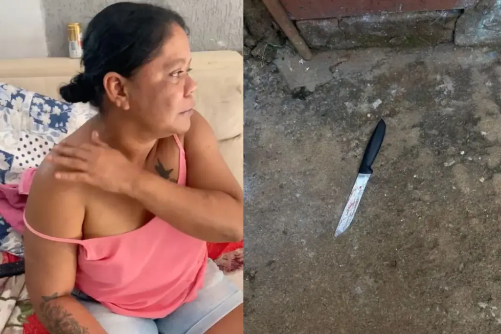 Maria Aldaci aponta ferimentos e afirma ter sido agredida pelo companheiro antes do episódio que terminou com a morte dele. (Vídeo: Reprodução)