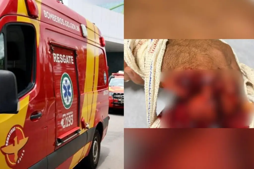 homem perde dois dedos em Anápolis