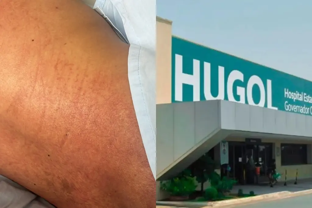 Após 10 dias internado em Anápolis em estado delicado, homem com coluna fraturada consegue transferência para hospital em Goiânia